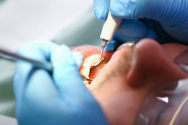Best Broken or Cracked Tooth Emergency Dentist in Lone Jack, MO