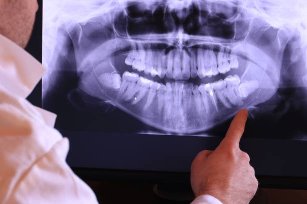 Best Urgent Dental Care for Toothache in Lone Jack, MO